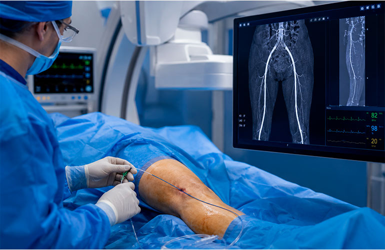 Intervencionismo vascular